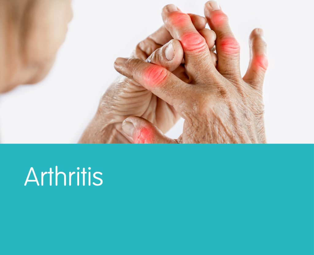 Arthritis - YLP