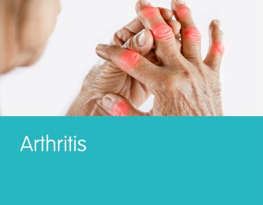 Arthritis - YLP