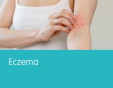 Eczema - YLP